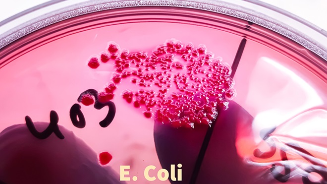 Escherichia coli