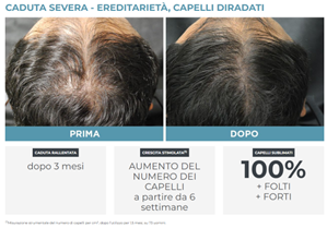 Phytocyane capelli diradati