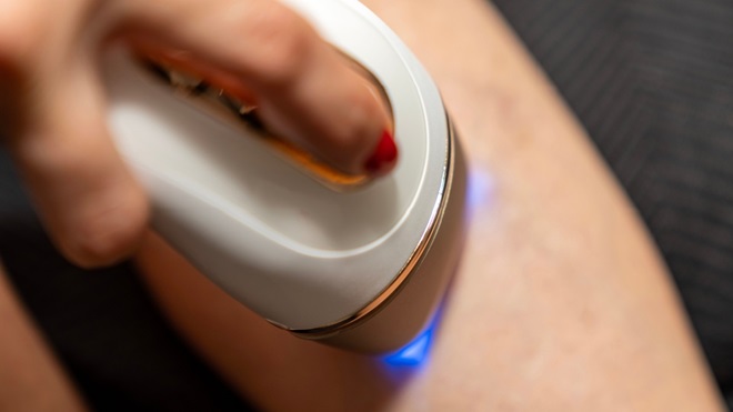 Epilatore laser