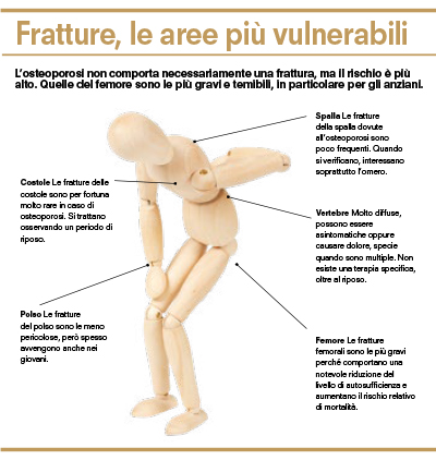 Infografica osteoporosi